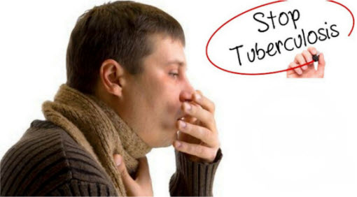 Penyakit TBC